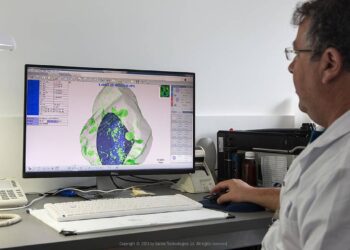 Sarine Technologies Reports FY2024 Profit Amid Industry Headwinds